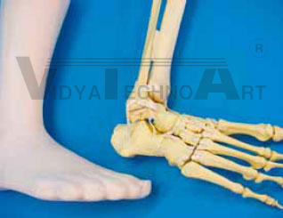 Foot single bones, fractured, foam coat 90°